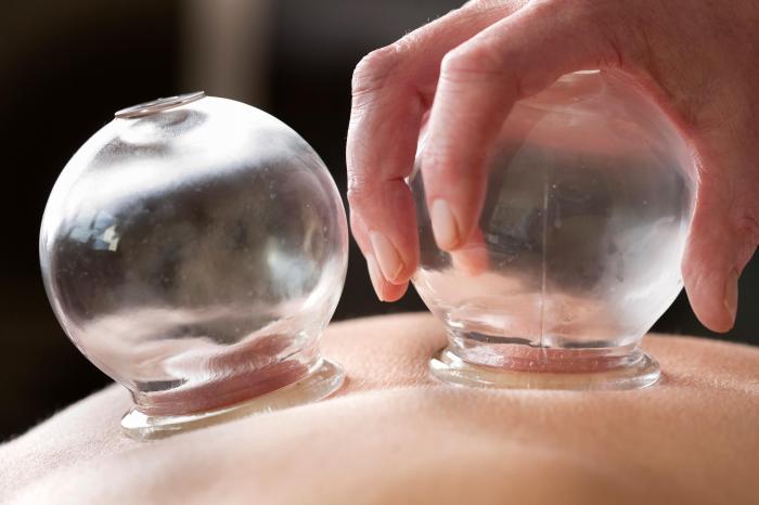 How Does Cupping Help?